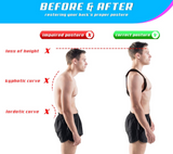 Adjustable Posture Corrector - Back Support & Pain Relief - Brace Professionals -