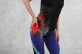 Women's Sciatic Hip Brace ~ Sciatica Nerve Pain Relief! - Brace Professionals -