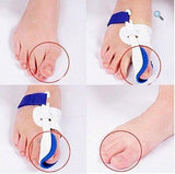 Bunion Corrector Brace & Splint ~ Pain Relief! - Brace Professionals -